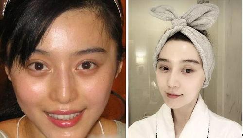 汕头明星整容医院